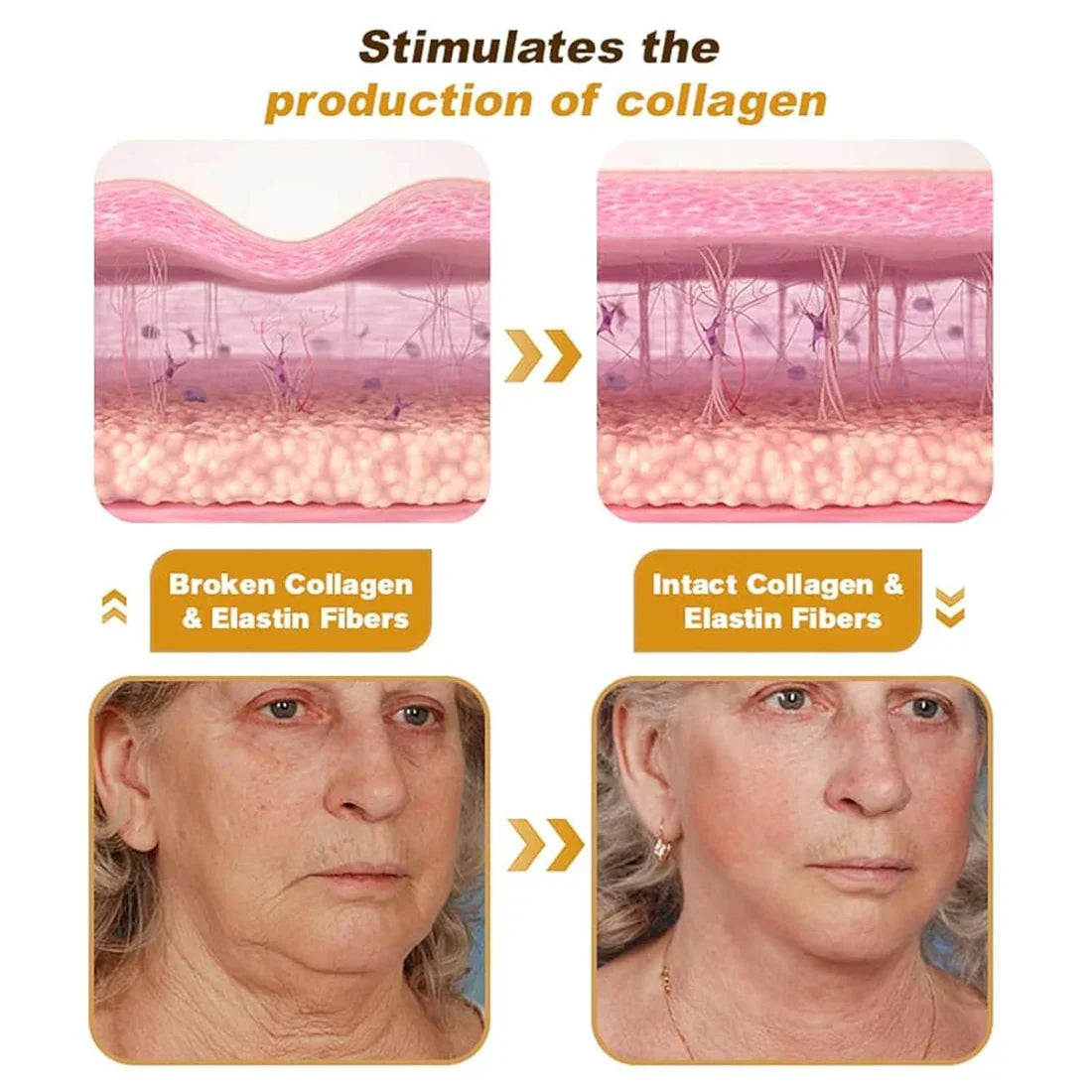 Bee Venom Wrinkle Repair Cream đâ¨
